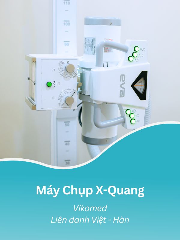 Máy Chụp X-Quang Tại Doctor Check