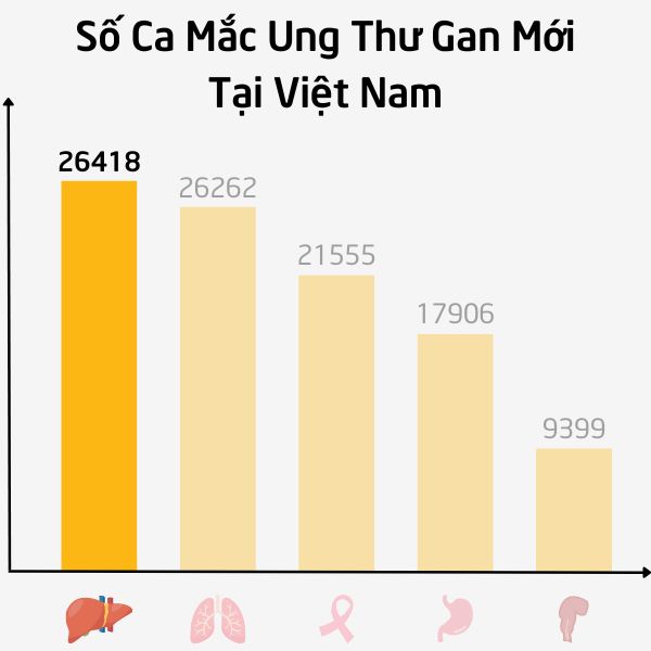 Số Ca Mắc Ung Thư Gan Mới