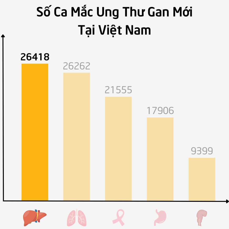 Số Ca Mắc Ung Thư Gan Mới